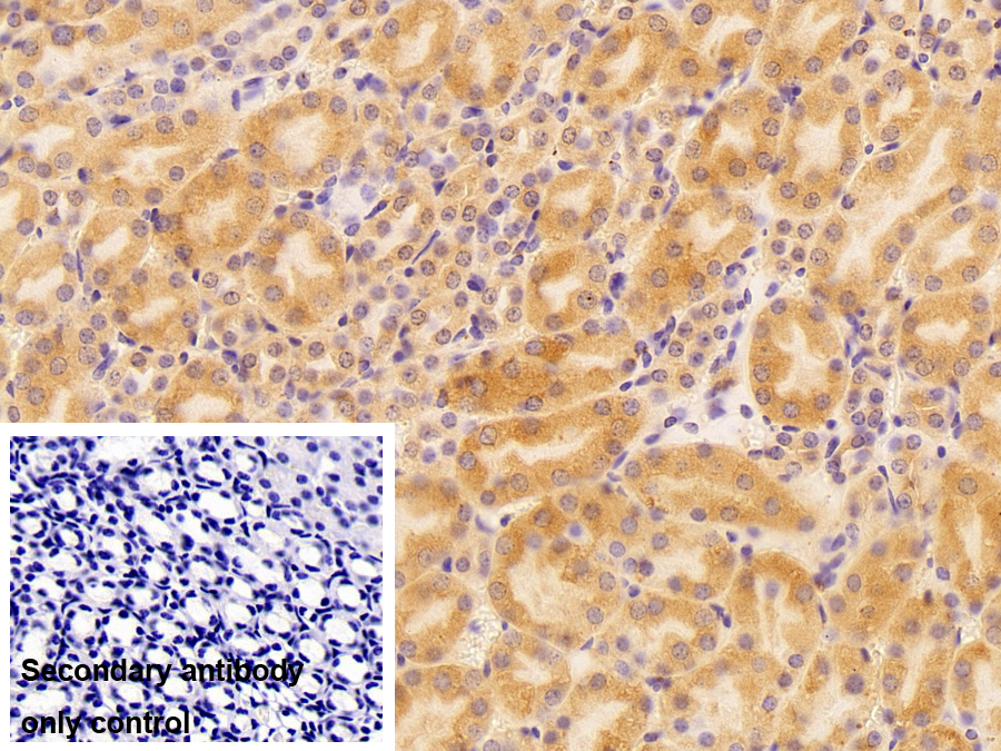 Polyclonal Antibody to Heat Shock Protein 90kDa Beta 1 (HSP90b1)
