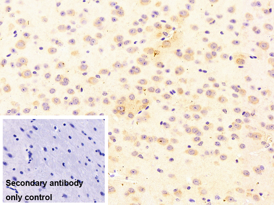 Polyclonal Antibody to Heat Shock Protein 90kDa Beta 1 (HSP90b1)