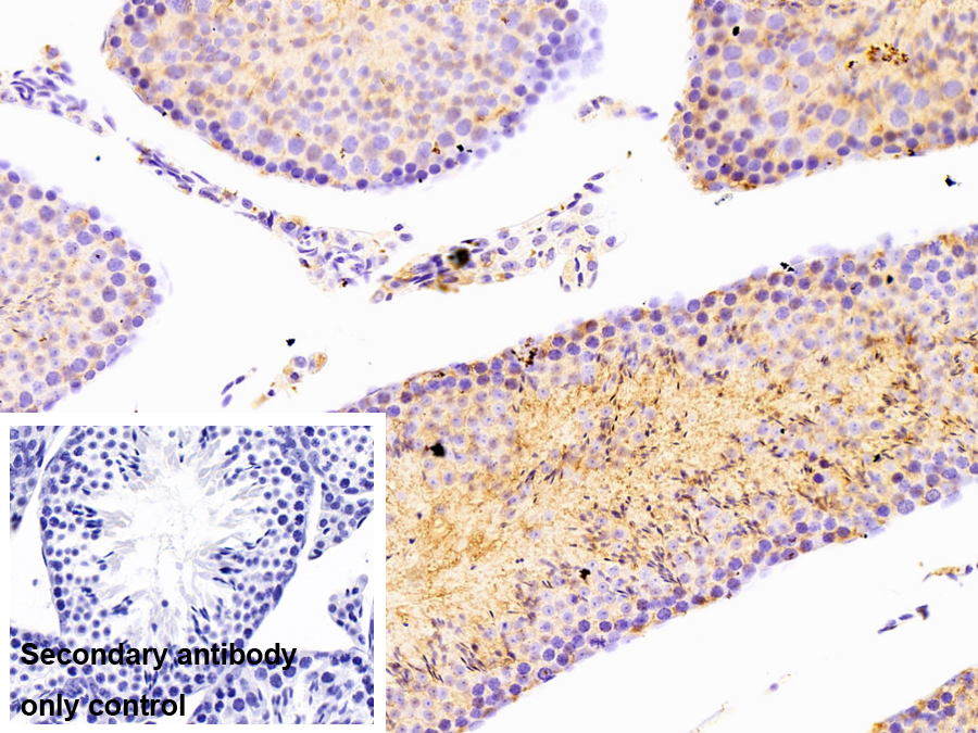 Polyclonal Antibody to Heat Shock Protein 90kDa Beta 1 (HSP90b1)