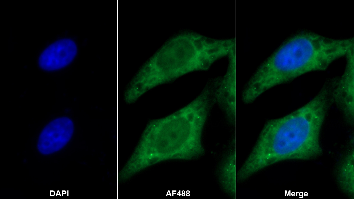 Polyclonal Antibody to Heat Shock Protein 90kDa Beta 1 (HSP90b1)