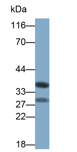 Polyclonal Antibody to Tumor Necrosis Factor Ligand Superfamily, Member 14 (TNFSF14)