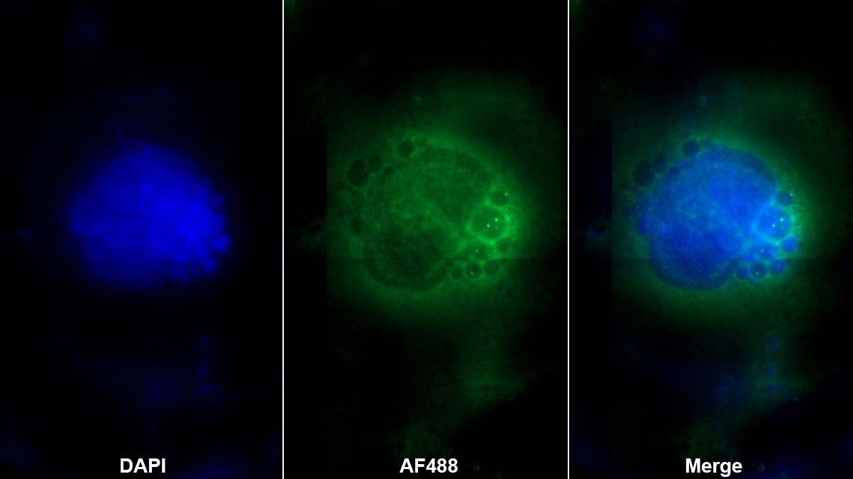 Polyclonal Antibody to Nitric Oxide Synthase 2, Inducible (NOS2)