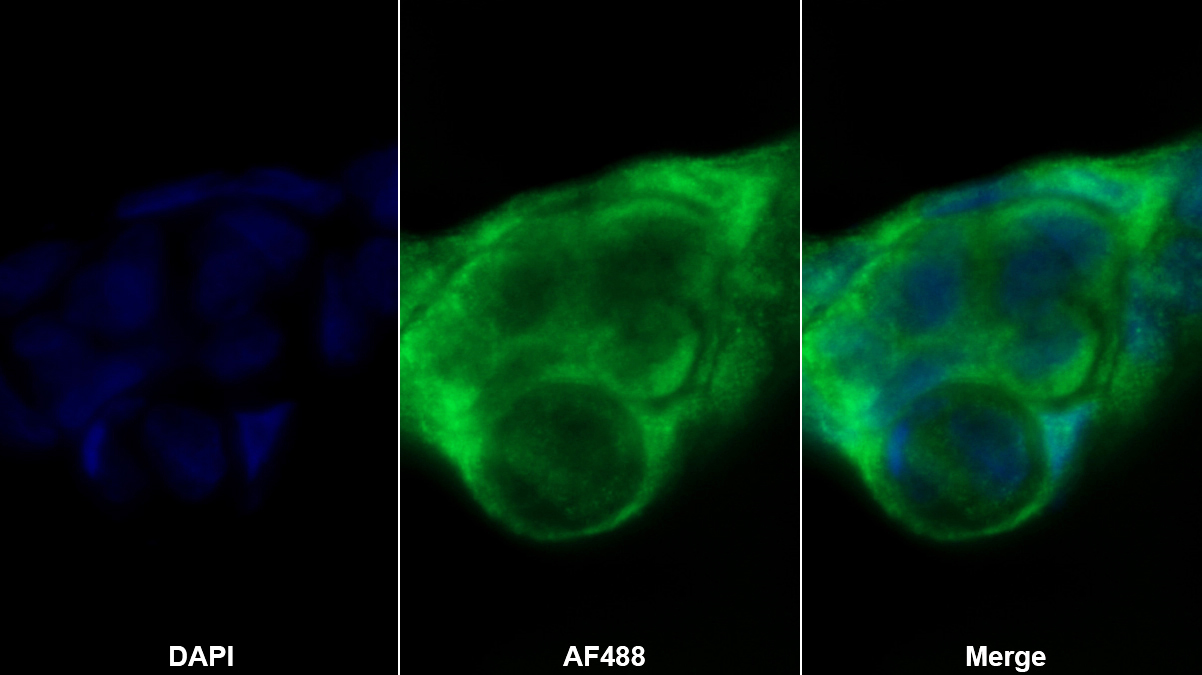 Polyclonal Antibody to Von Willebrand Factor A Domain Containing Protein 1 (vWA1)