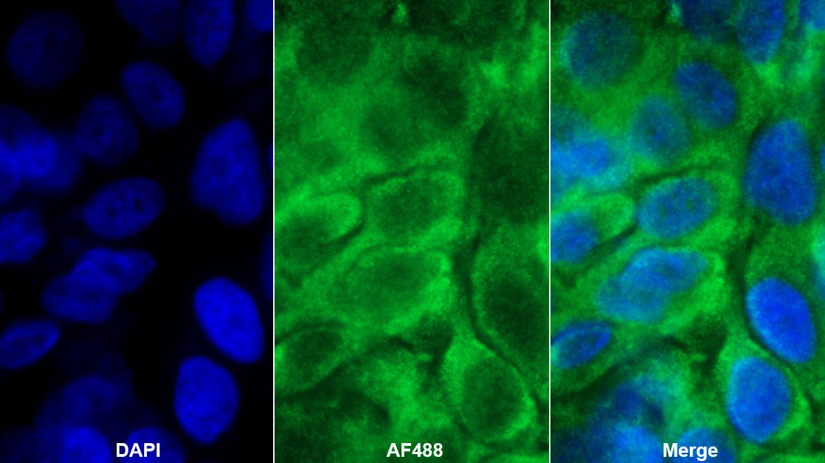 Polyclonal Antibody to Glycogen Phosphorylase, Liver (PYGL)