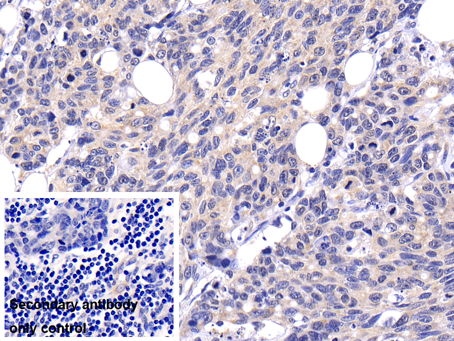 Polyclonal Antibody to Caspase 8 (CASP8)