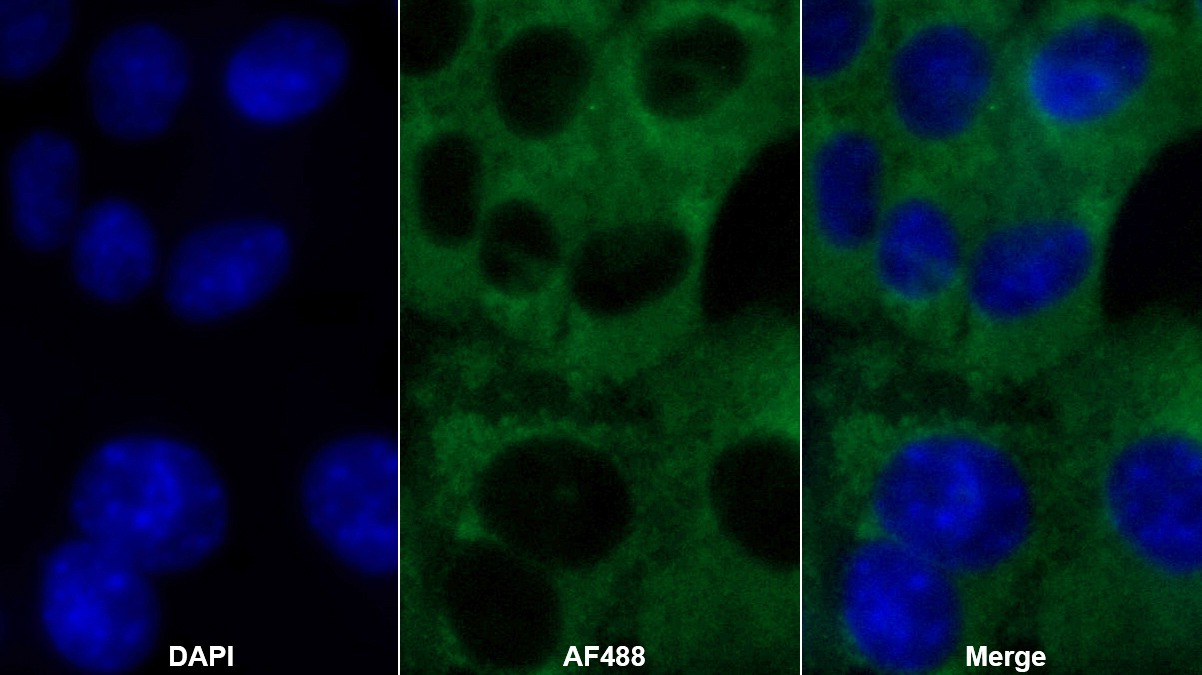 Polyclonal Antibody to Caspase 8 (CASP8)