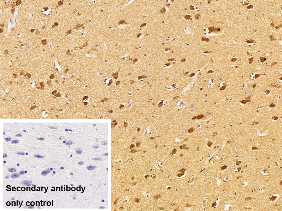 Polyclonal Antibody to Amyloid Beta Peptide 1-40 (Ab1-40)