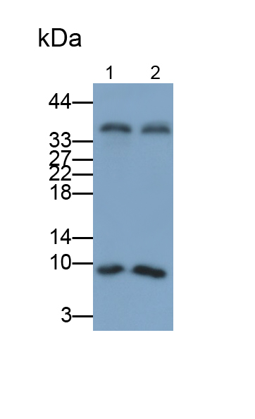 Polyclonal Antibody to Parathyroid Hormone (PTH)