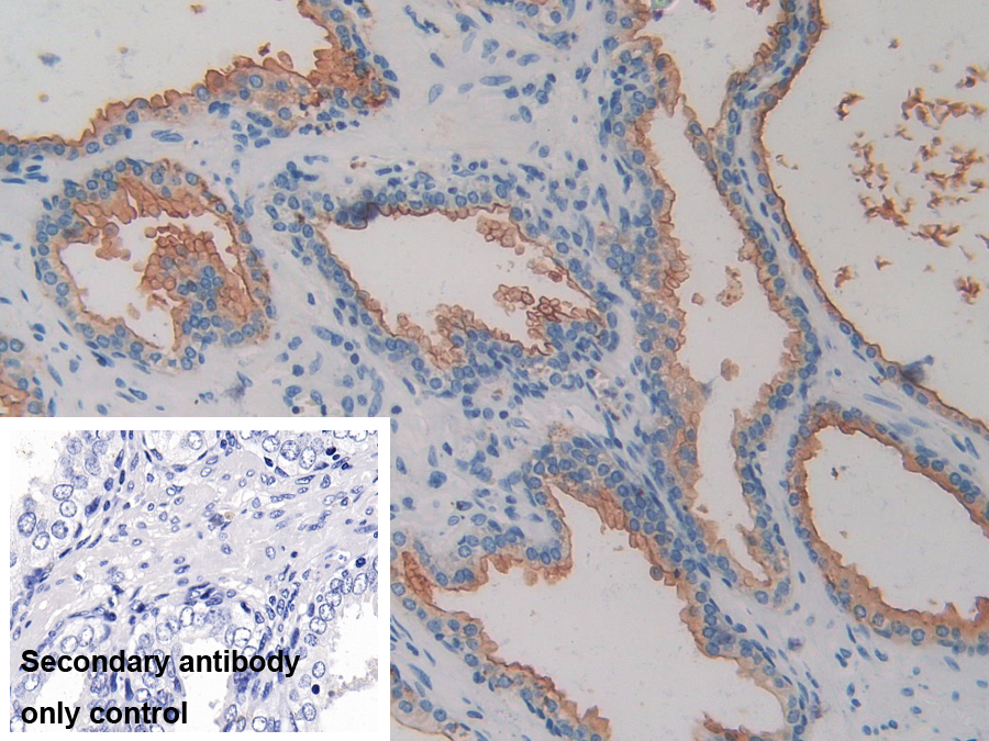 Polyclonal Antibody to Cluster Of Differentiation 26 (CD26)