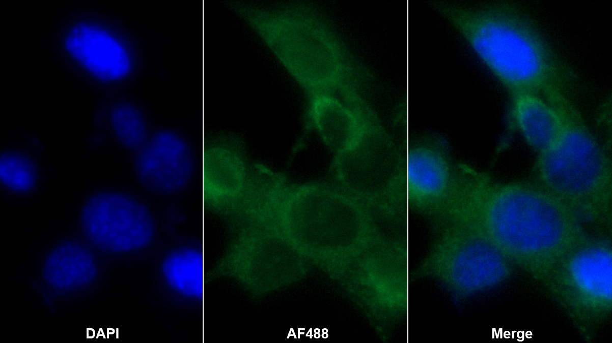 Polyclonal Antibody to Serum Amyloid A (SAA)