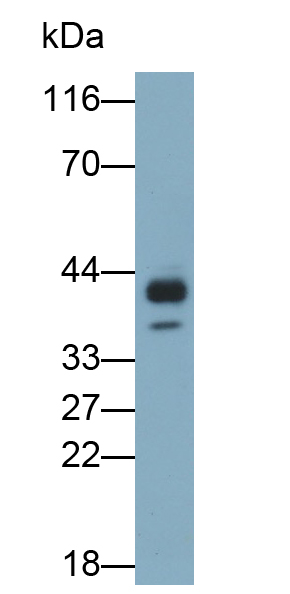 Polyclonal Antibody to Chemokine C-C-Motif Receptor 3 (CCR3)