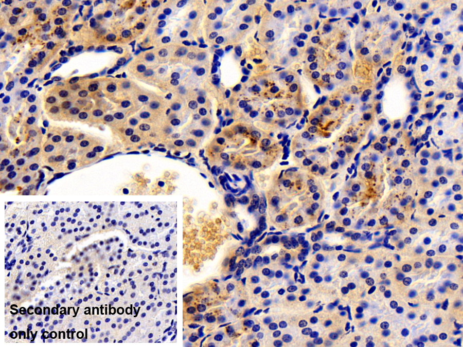 Polyclonal Antibody to Retinol Binding Protein 4 (RBP4)