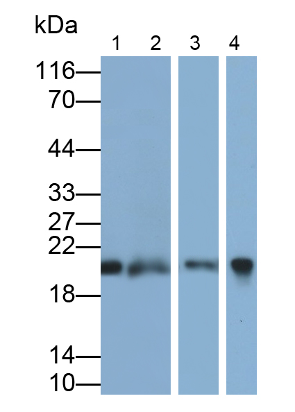 Polyclonal Antibody to Retinol Binding Protein 4 (RBP4)