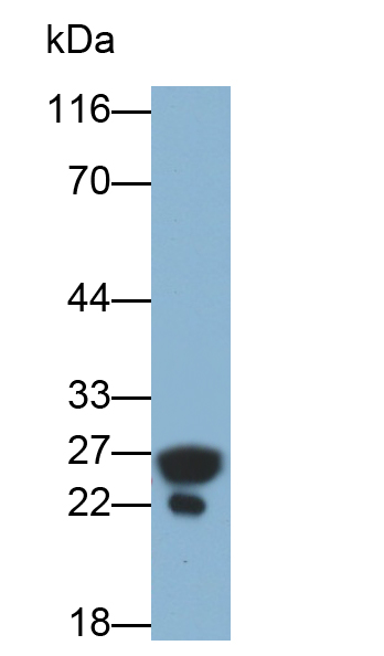 Polyclonal Antibody to Retinol Binding Protein 4 (RBP4)