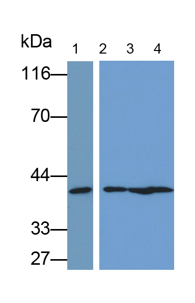 Polyclonal Antibody to Extracellular Signal Regulated Kinase 2 (ERK2)