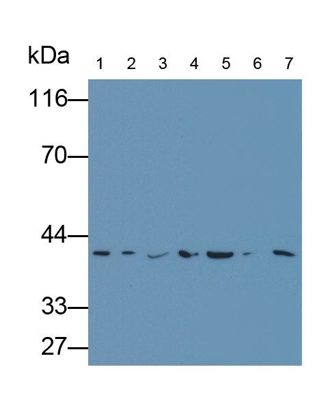 Polyclonal Antibody to Extracellular Signal Regulated Kinase 2 (ERK2)