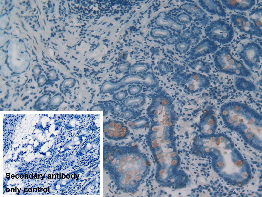 Polyclonal Antibody to Intelectin 1 (ITLN1)