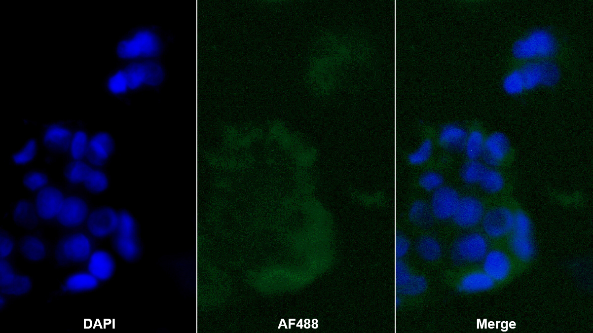 Polyclonal Antibody to Chemerin (CHEM)