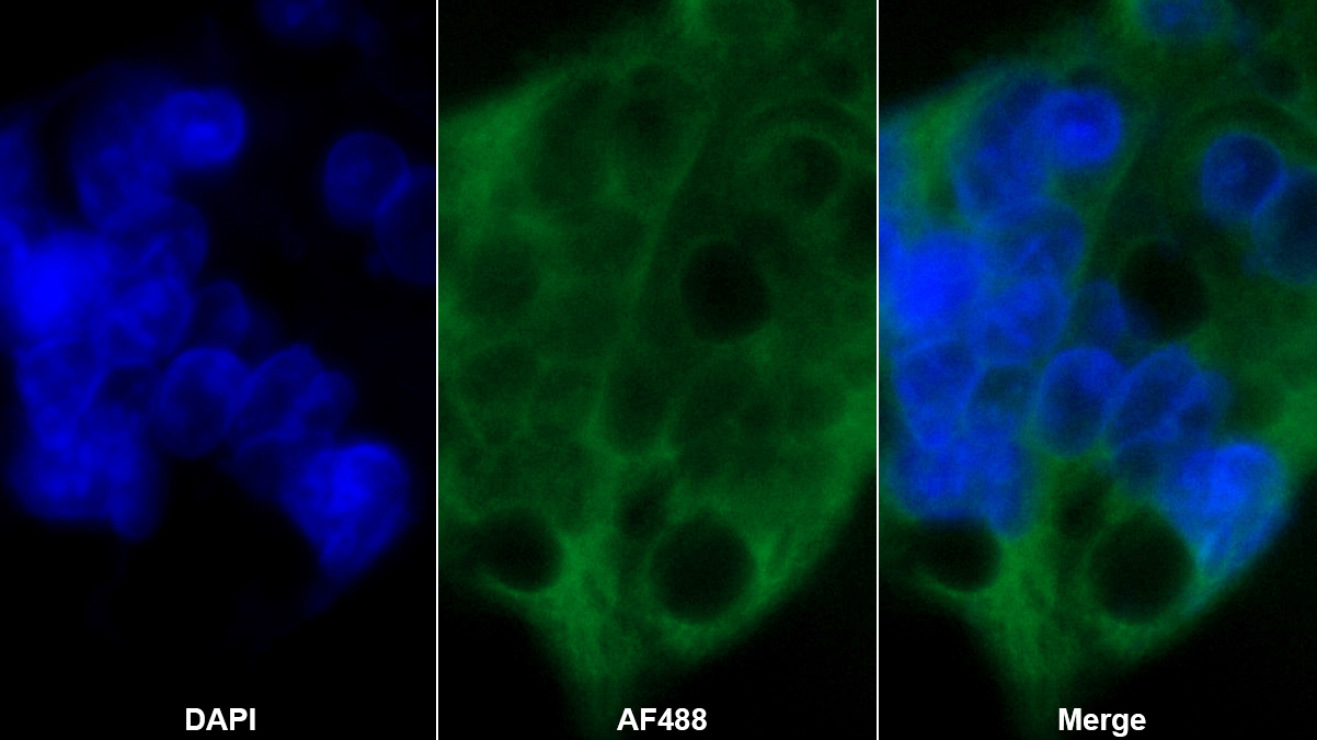 Polyclonal Antibody to Chemerin (CHEM)