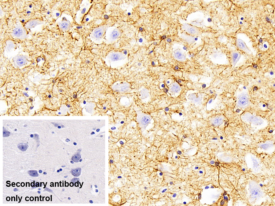 Polyclonal Antibody to Amyloid Beta Peptide 1-42 (Ab1-42)