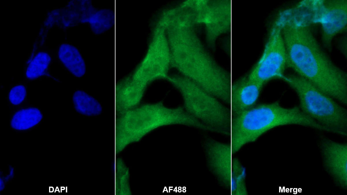 Polyclonal Antibody to Cyclophilin A (CYPA)