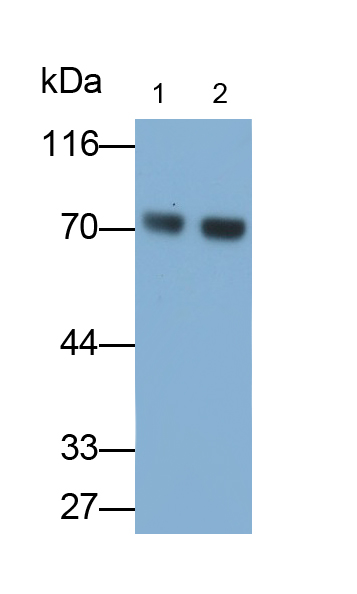 Polyclonal Antibody to Alpha-1-Antichymotrypsin (a1ACT)