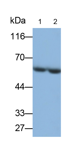 Polyclonal Antibody to Alpha-1-Antichymotrypsin (a1ACT)