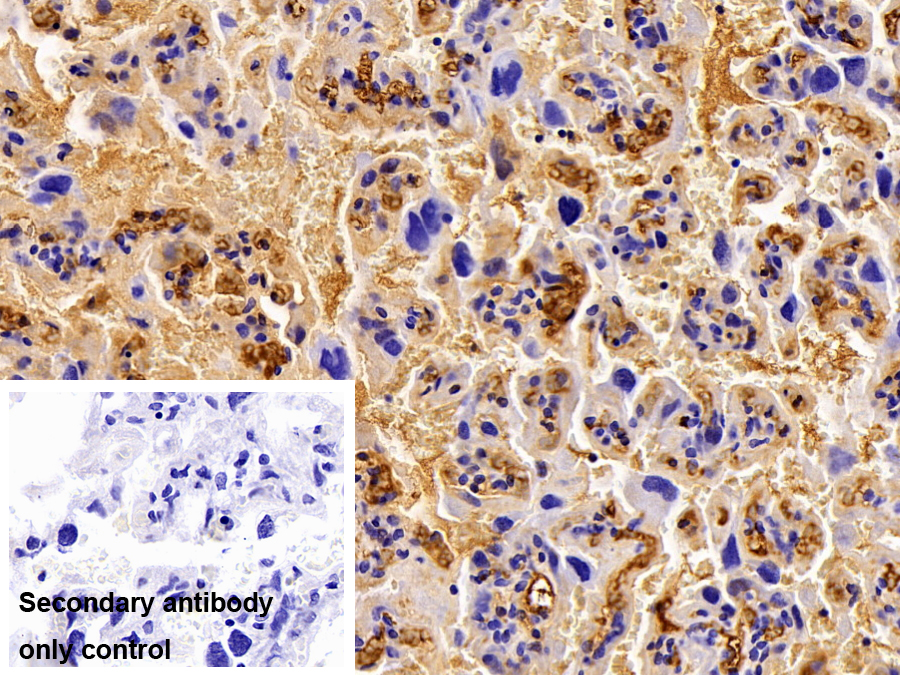 Polyclonal Antibody to Alpha-2-Macroglobulin (a2M)