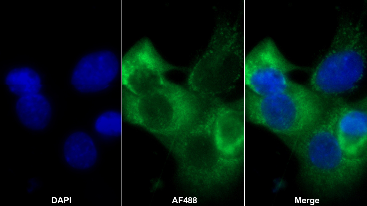 Polyclonal Antibody to Alpha-2-Macroglobulin (a2M)