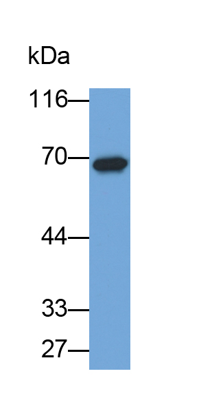 Polyclonal Antibody to Albumin (ALB)