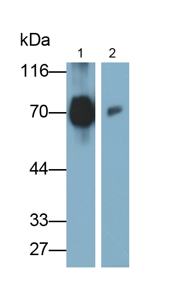 Polyclonal Antibody to Albumin (ALB)