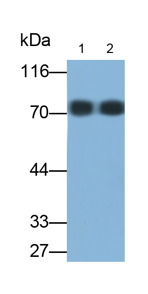 Polyclonal Antibody to Albumin (ALB)