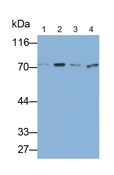 Polyclonal Antibody to Growth Hormone Receptor (GHR)