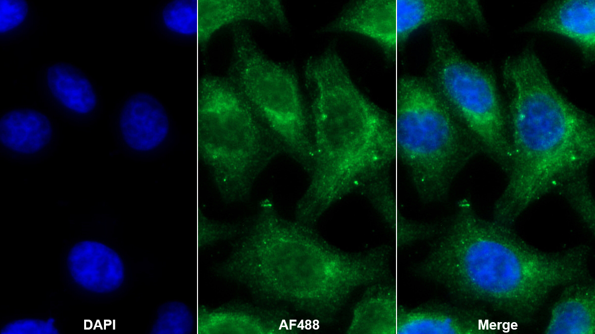 Polyclonal Antibody to Vimentin (VIM)