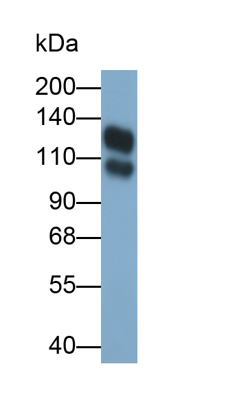 Polyclonal Antibody to Integrin Beta 1 (ITGb1)