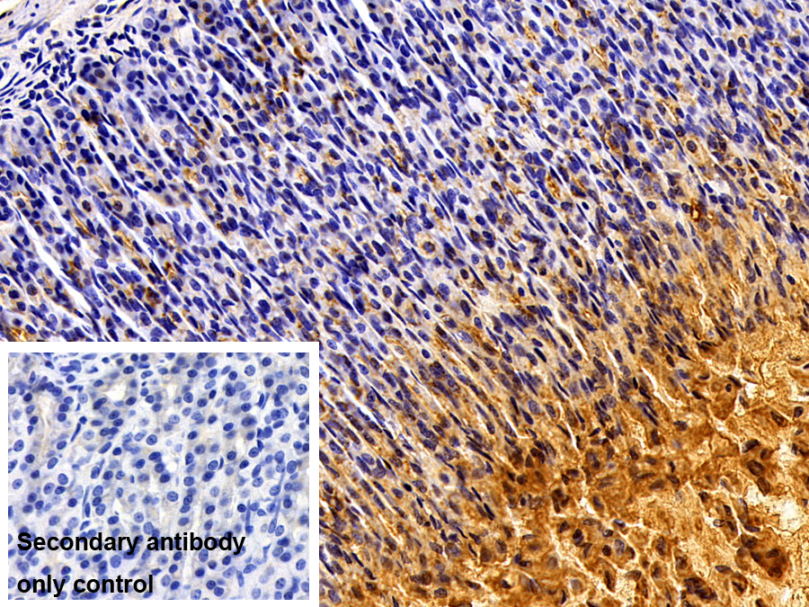 Polyclonal Antibody to Trefoil Factor 1 (TFF1)