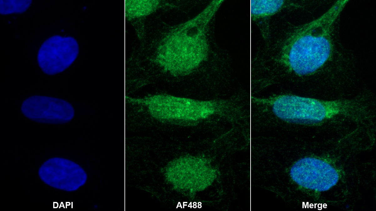 Polyclonal Antibody to Transcriptional Activator Myb (c-Myb)