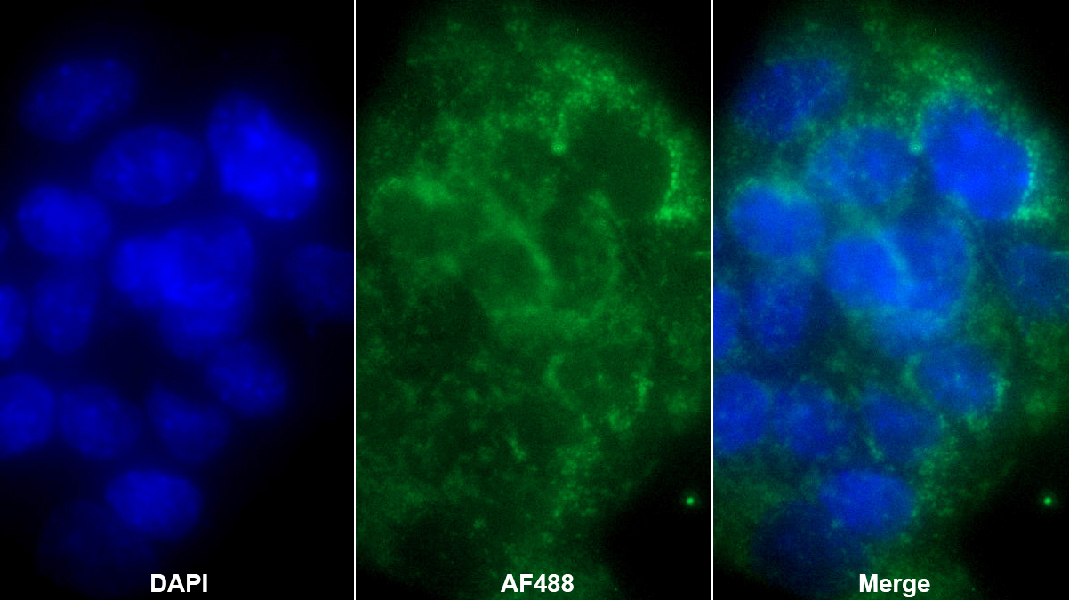 Polyclonal Antibody to Apoptosis Inducing Factor (AIF)