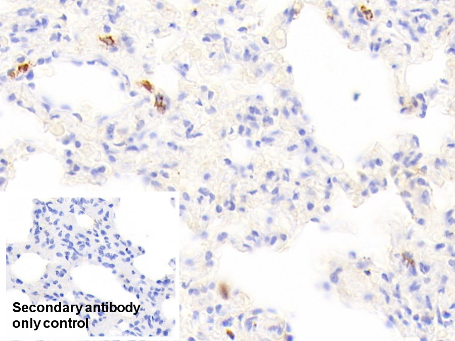 Polyclonal Antibody to Tryptase (TPS)