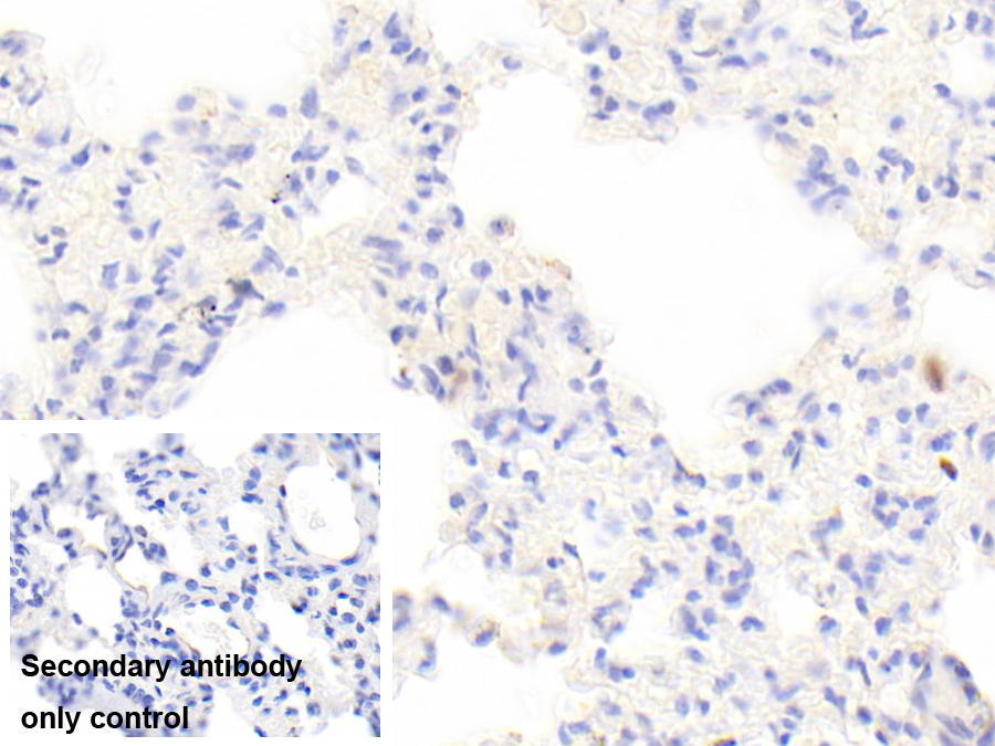 Polyclonal Antibody to Tryptase (TPS)