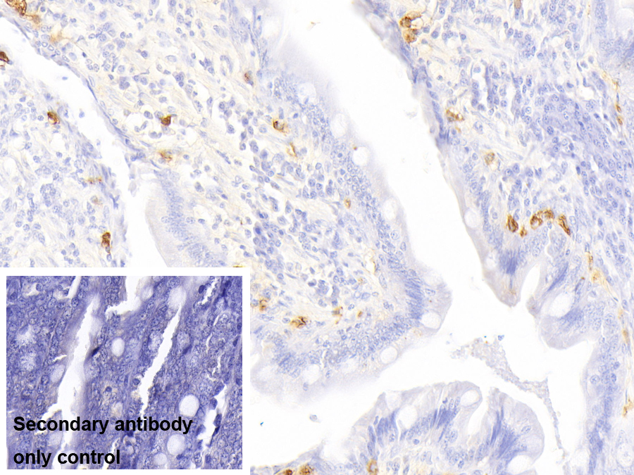 Polyclonal Antibody to Tryptase (TPS)