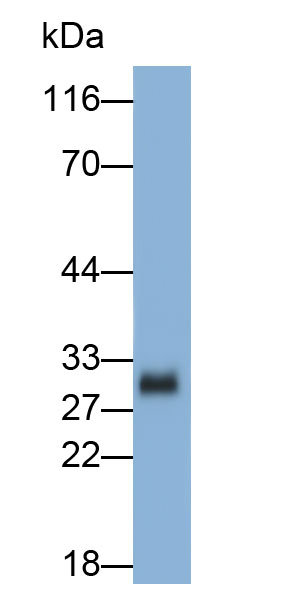 Polyclonal Antibody to Tryptase (TPS)