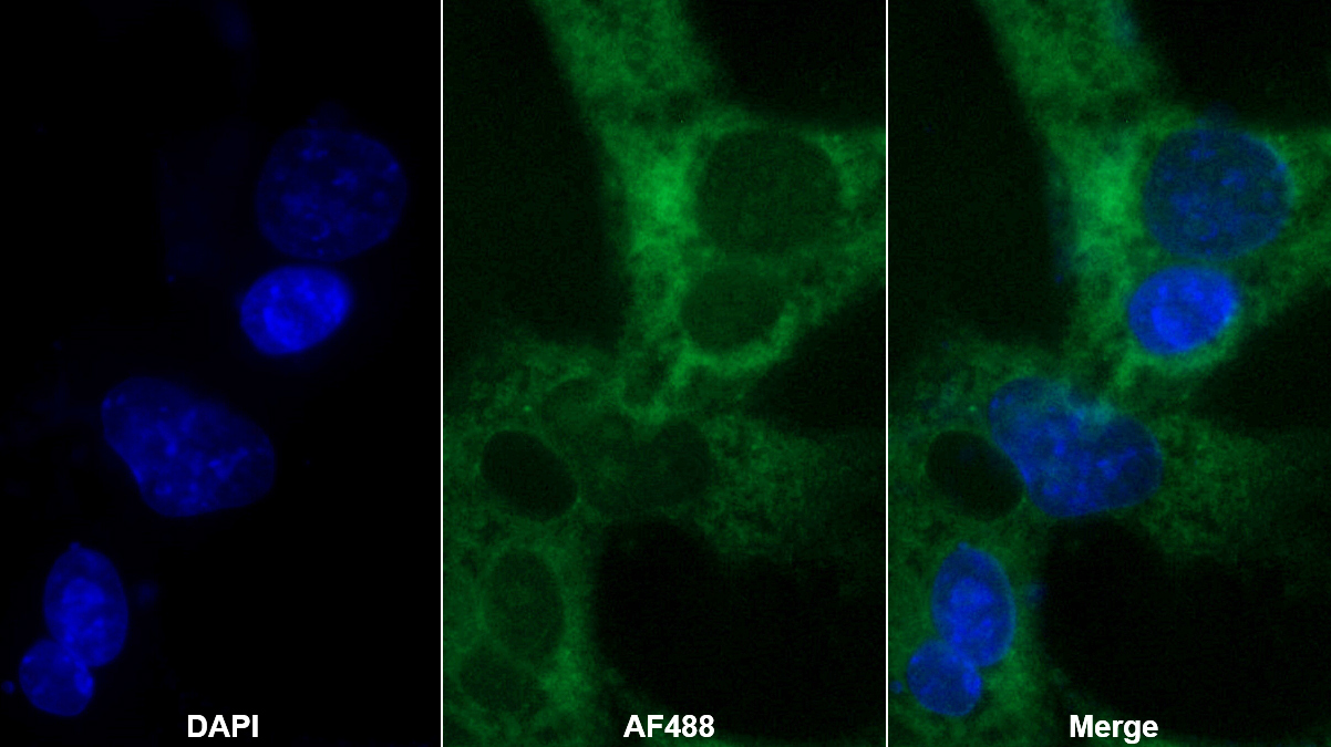 Polyclonal Antibody to Tryptase (TPS)