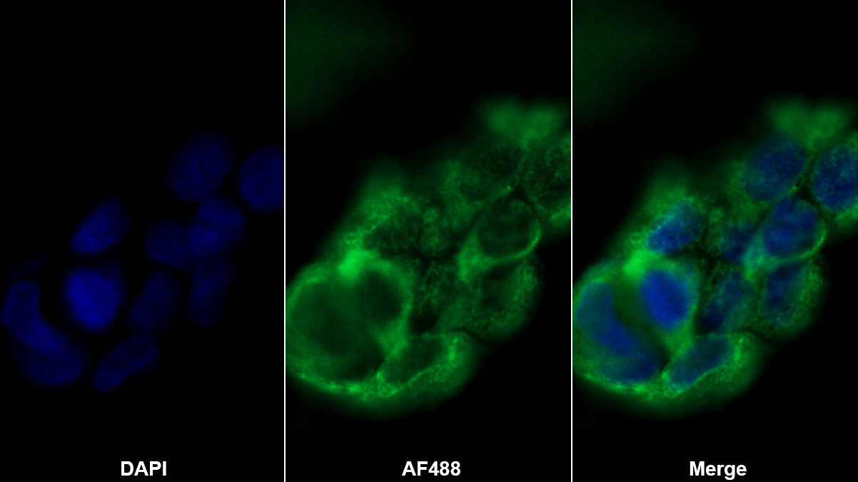 Polyclonal Antibody to Polymeric Immunoglobulin Receptor (PIGR)