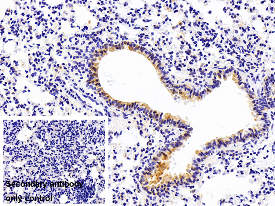 Polyclonal Antibody to General Transcription Factor IIH Subunit 1 (GTF2H1)