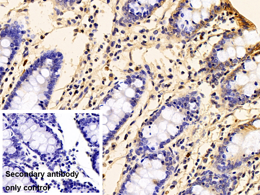 Polyclonal Antibody to S100 Calcium Binding Protein A12 (S100A12)