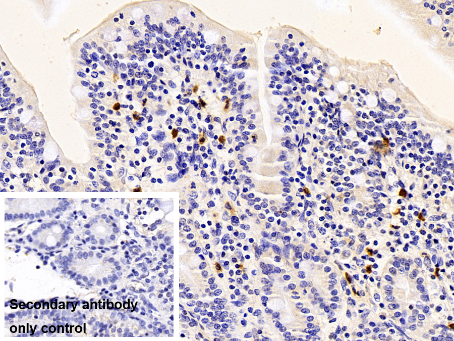 Polyclonal Antibody to S100 Calcium Binding Protein A12 (S100A12)