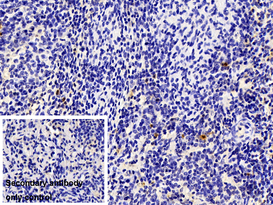 Polyclonal Antibody to S100 Calcium Binding Protein A12 (S100A12)