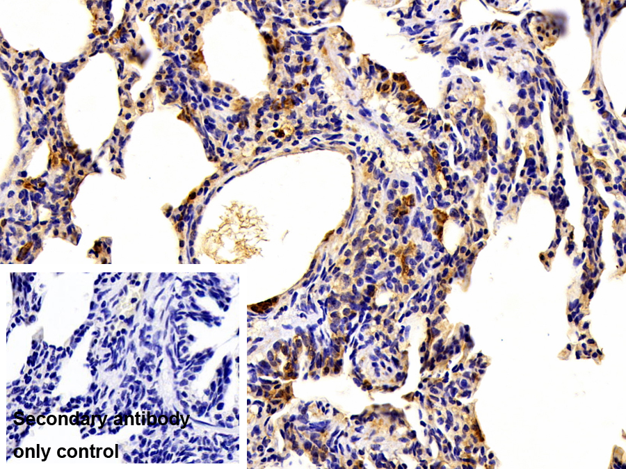 Polyclonal Antibody to S100 Calcium Binding Protein A12 (S100A12)