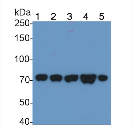 Polyclonal Antibody to Heat Shock 70kDa Protein 9 (HSPA9)